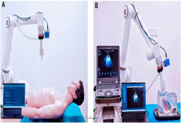 روبات محققان ایرانی عکسبرداری اولتراساوند را ایمن می کند